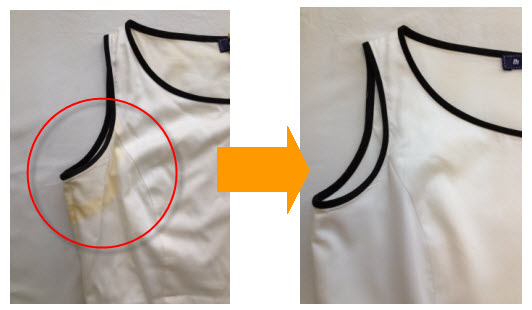 ワンピースの汗染み